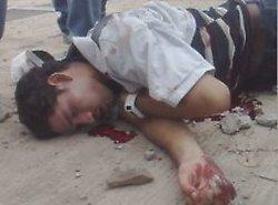 One of the Mitsubishi workers after the police attack