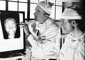 Doctors examine an x-ray of the brain